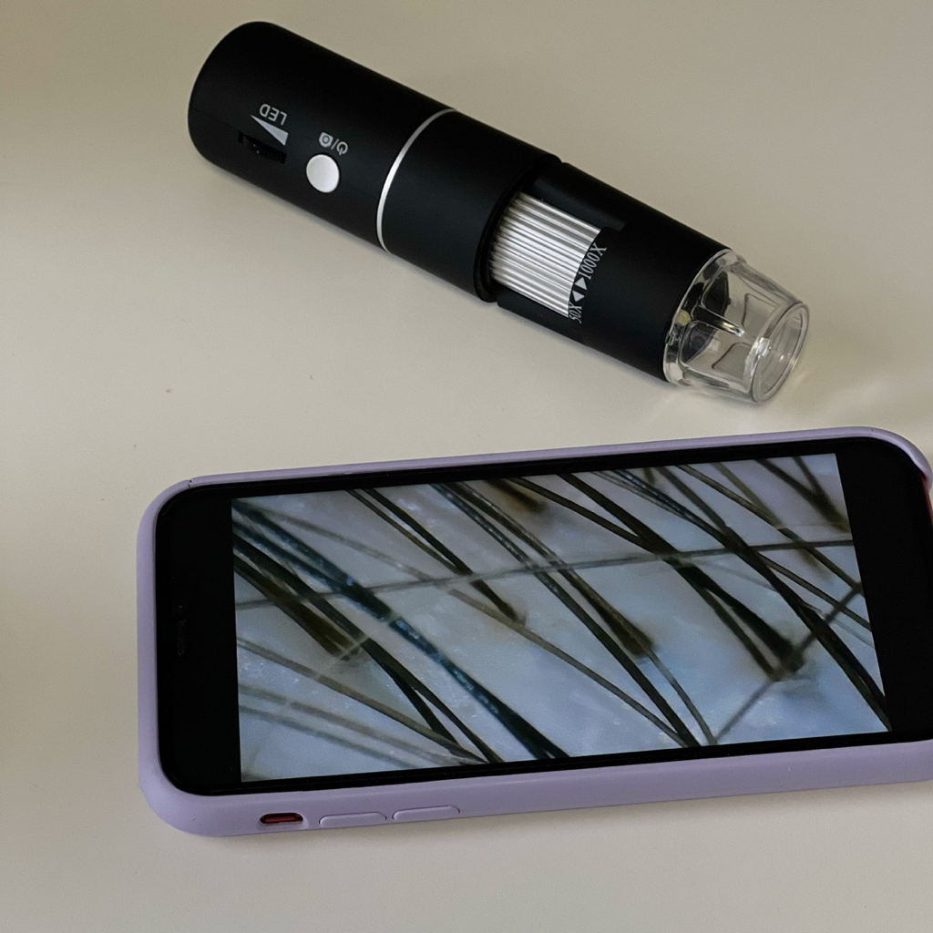 Пилинг кожи головы