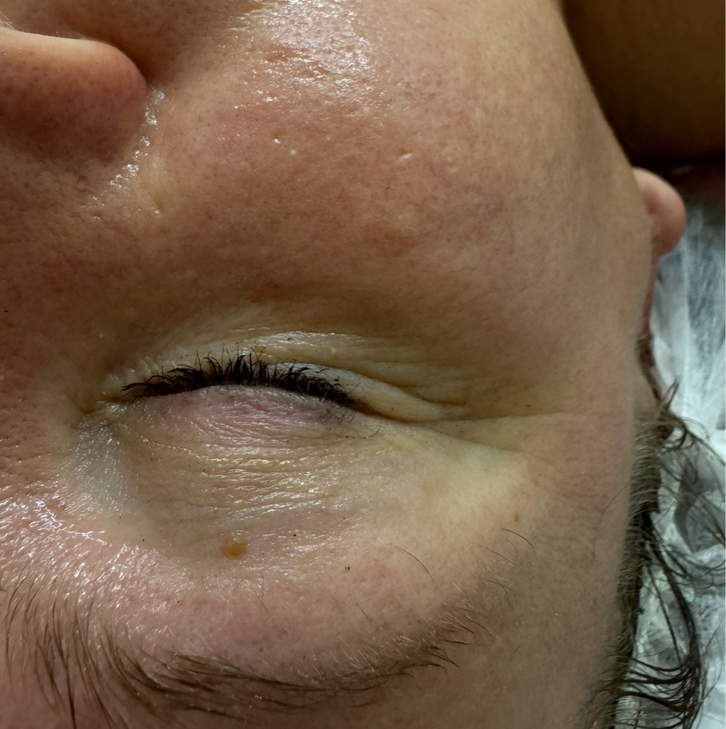 Массаж глаз Проработка глазных мышц , сняти синдрома усталых глаз 5 минут  600 рублей