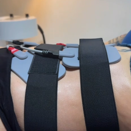 Миостимуляция