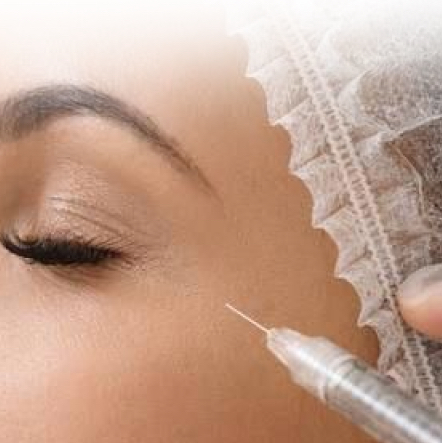 Ботулинотерапия