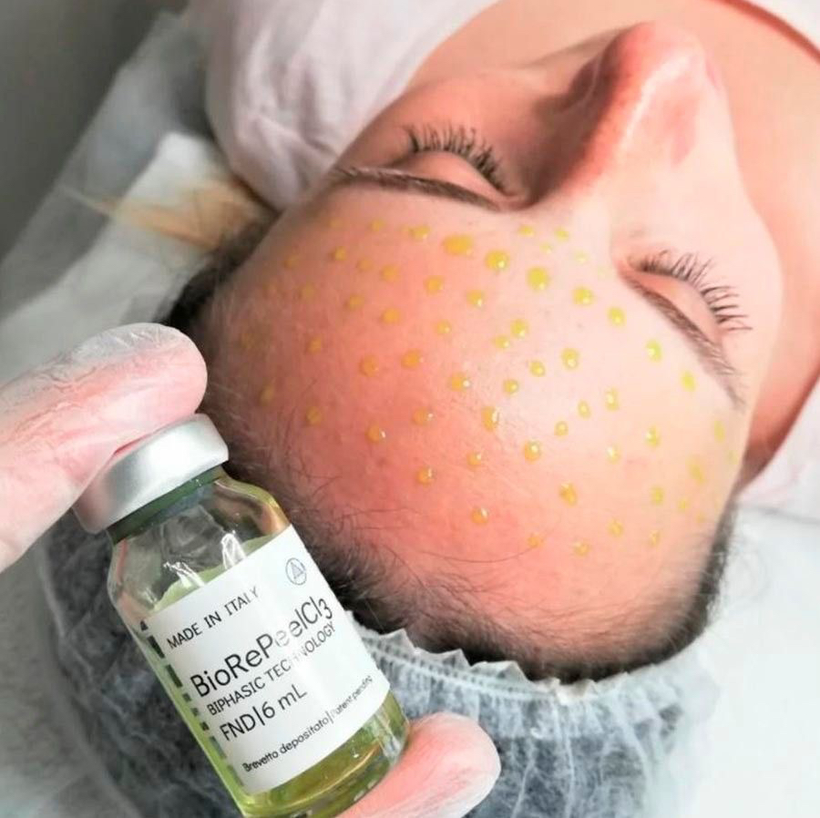 УЗ чистка + пилинг BioRePeelCl3 (Пилинг биоревитализант BioRePeelCl3 мгновенное омоложение, супер увлажнение и регенерация, заметно сужает поры и дела