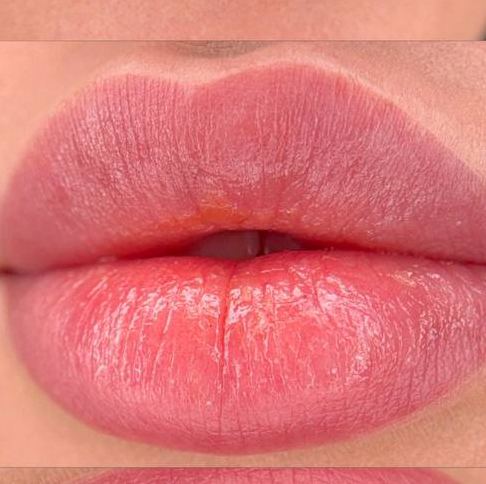 Биоревит+ПМ губ