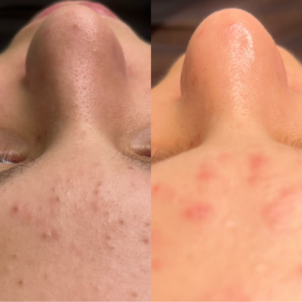 Стратегия чистых пор