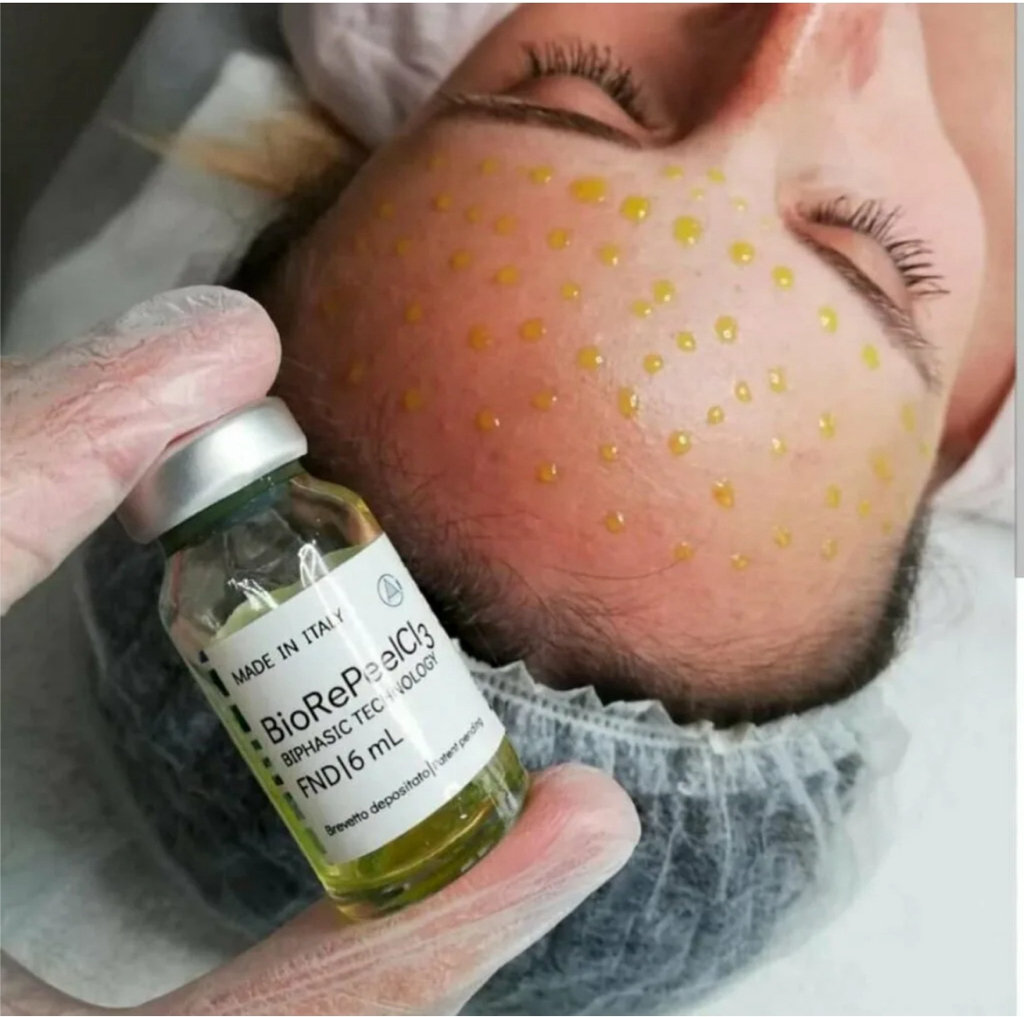 Дуплекс-обновление