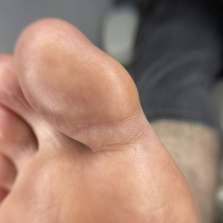 Мужской педикюр с обработкой стоп и пяток