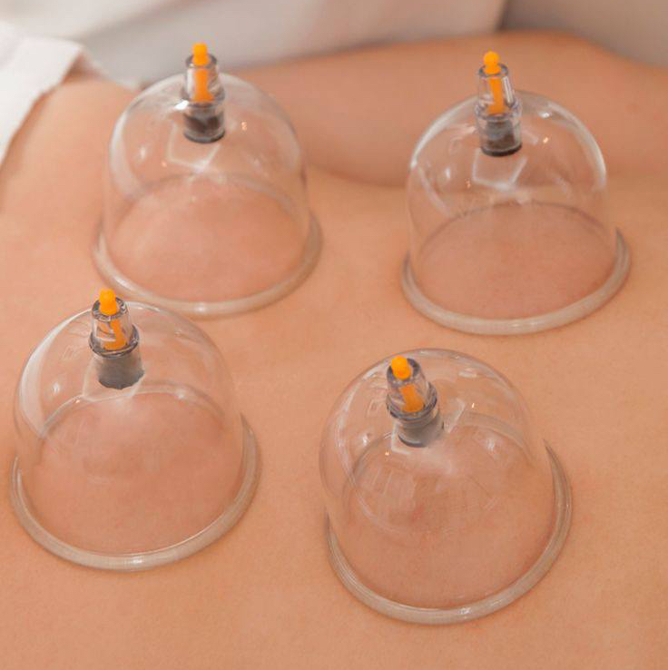 Массаж спины ( баночный )