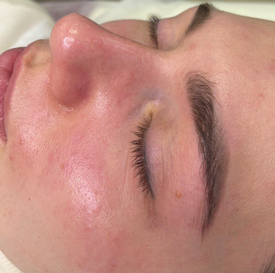 Анти-эйдж 2:0