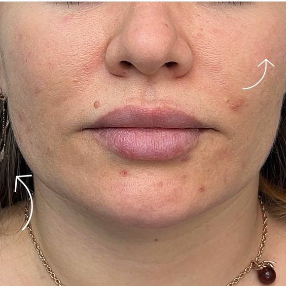 Формула двойного сияния