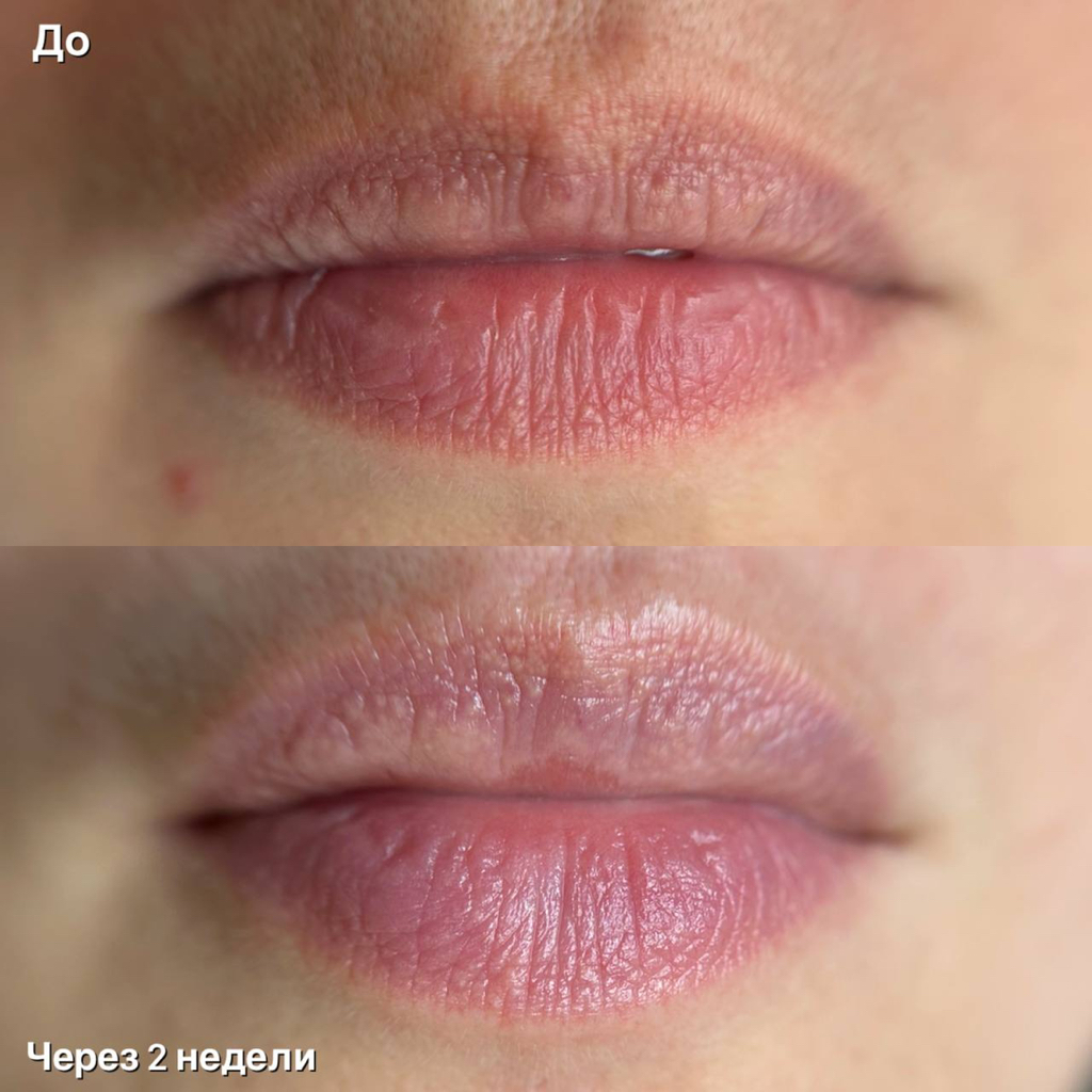 Био-увлажнение губ