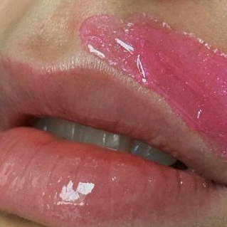 Депиляция лица