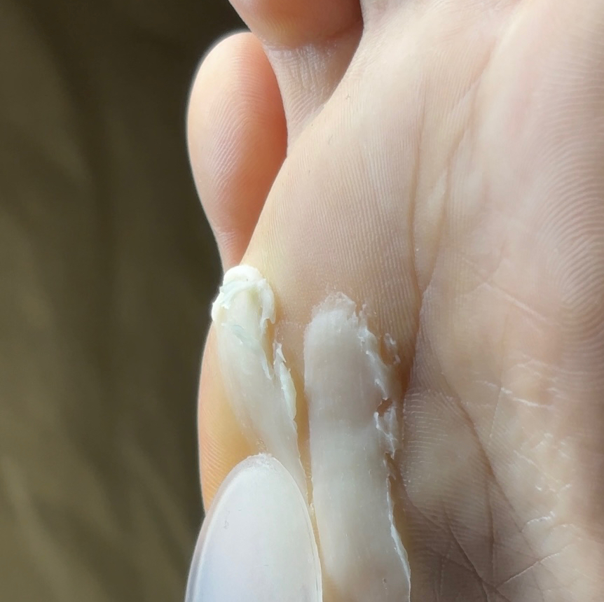 Парафинотерапия