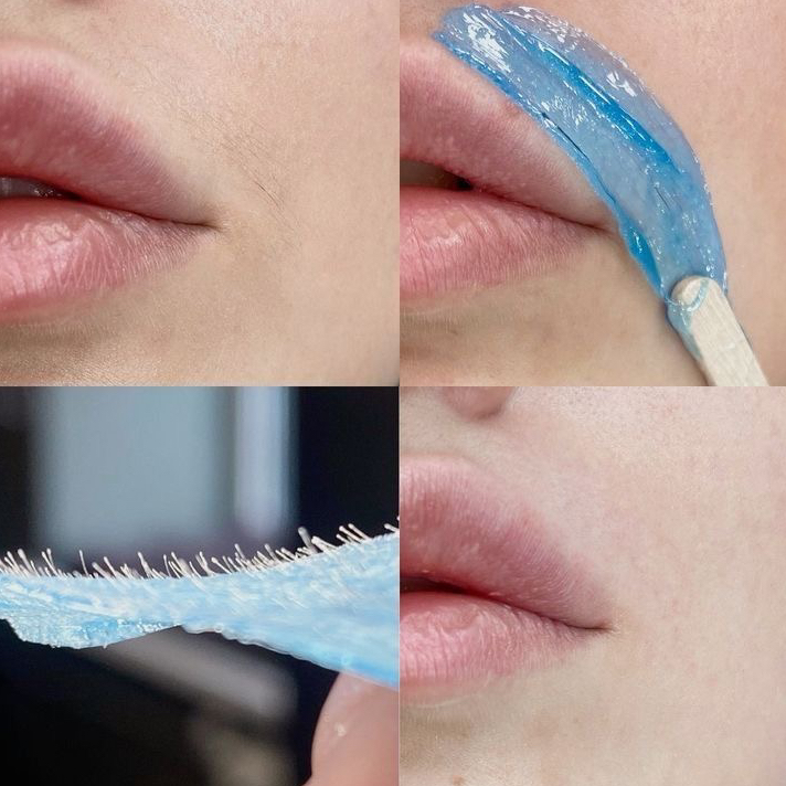 Депиляция зоны над губой + уход