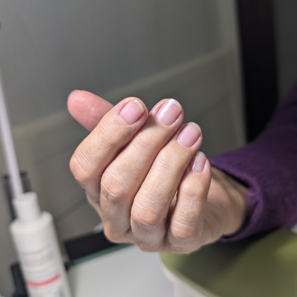 Снятие геля