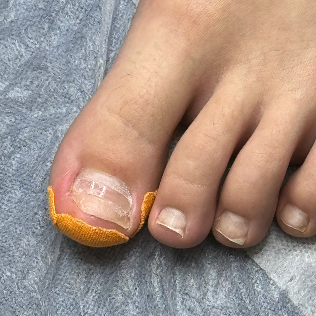 Установка Light System