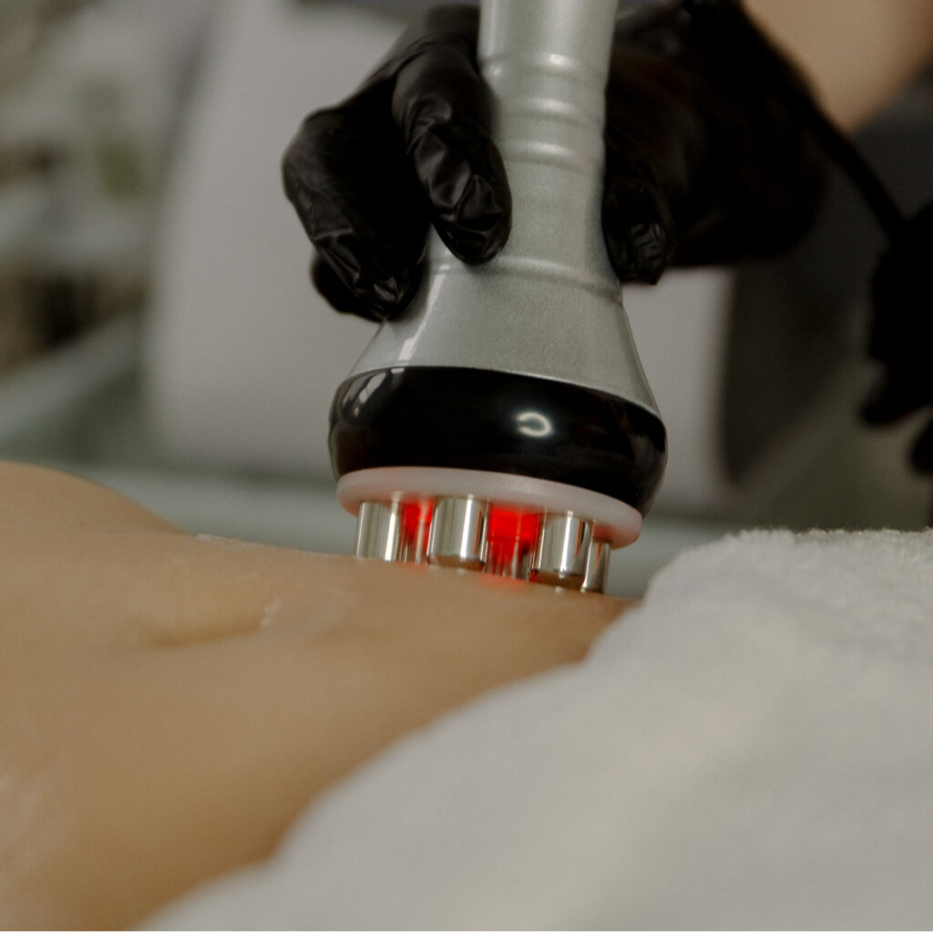 RF лифтинг(10 процедур/40мин)