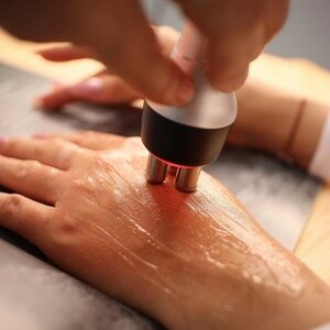 Rf лифтинг кистей рук