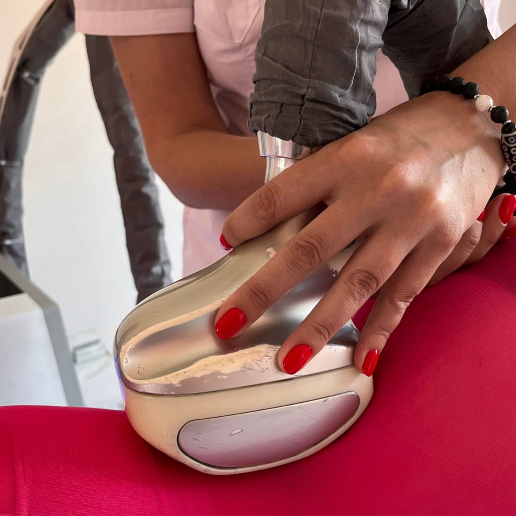 Пробное посещение LPG тело