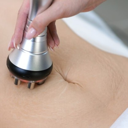 RF лифтинг(40мин)