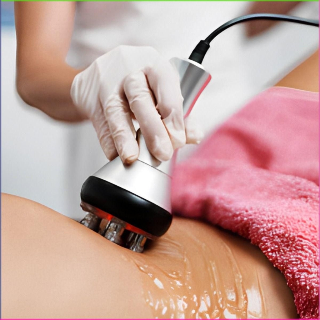 RF лифтинг(5процедур/20мин)