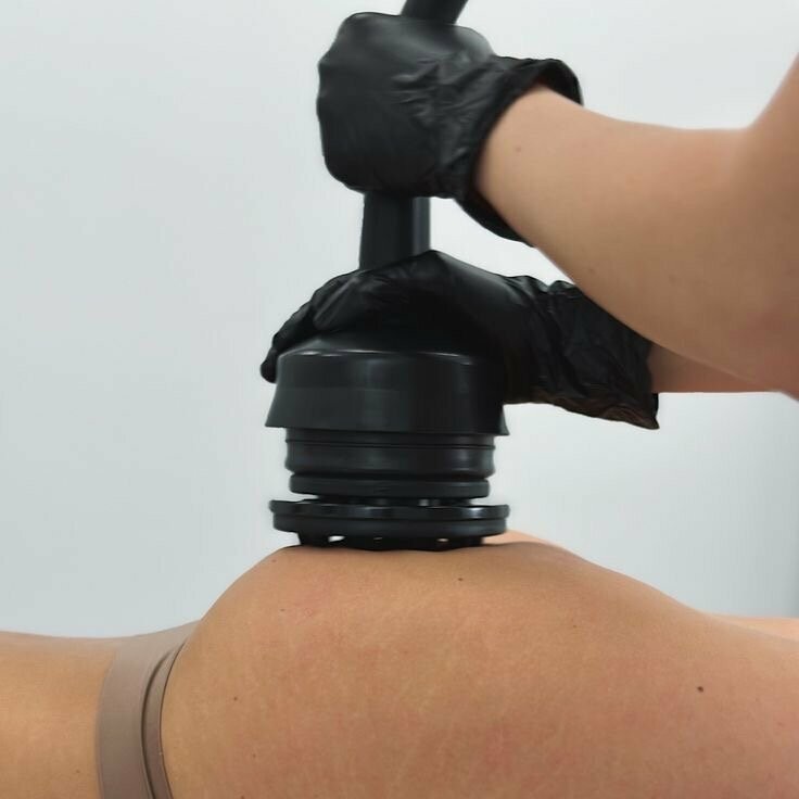 Вибромассаж(1 процедура)