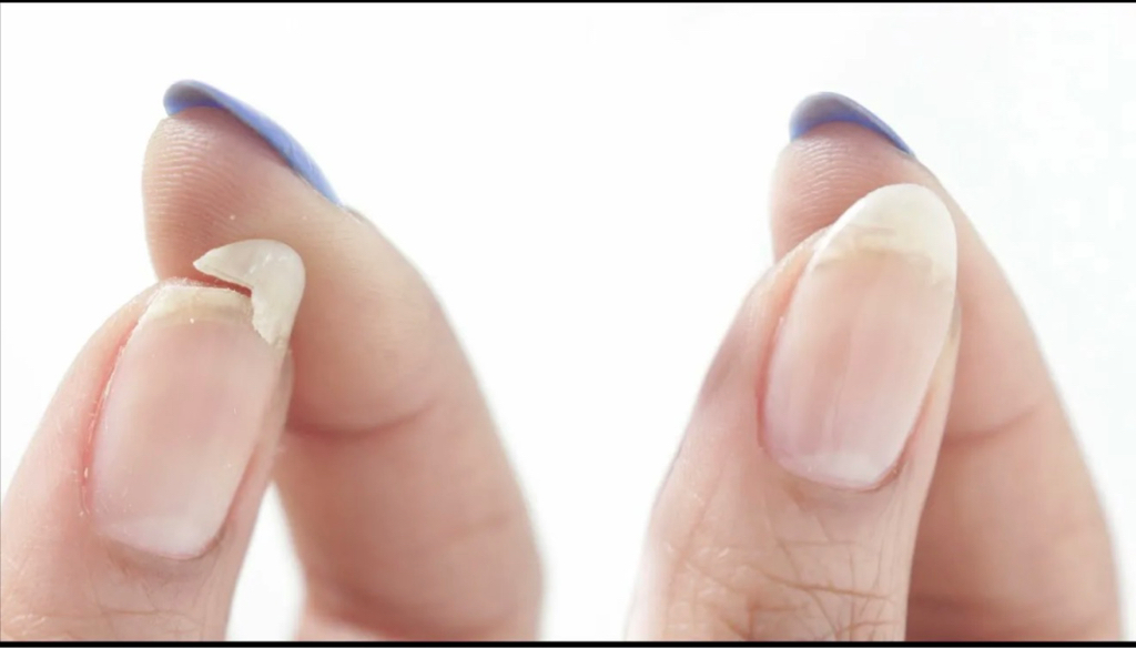 Мне нужно починить ноготь