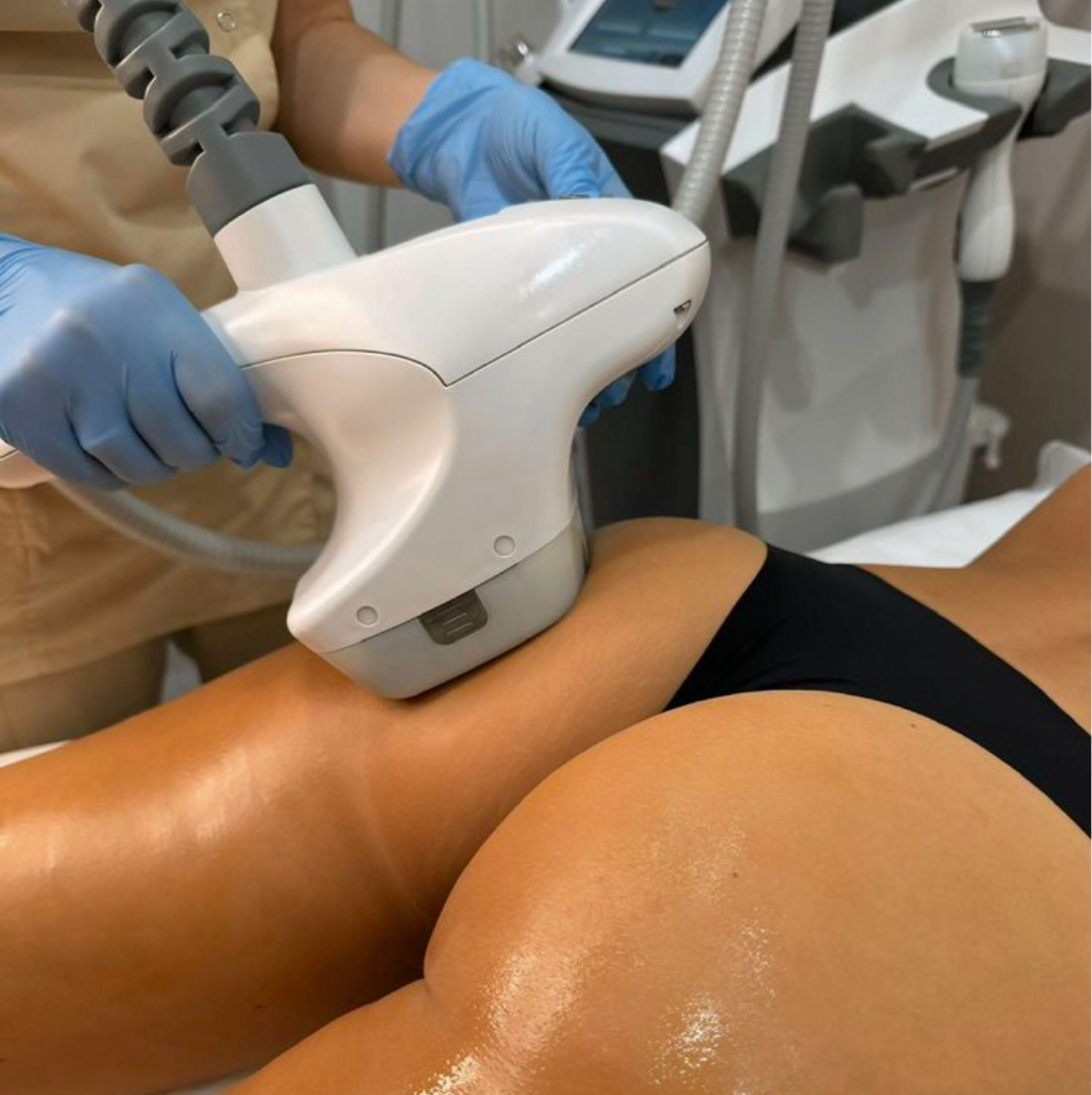 🟢70 мин. Сеанс УВЕЛИЧЕННОЙ ДЛИТЕЛЬНОСТИ - Велашейп / Эндосфера