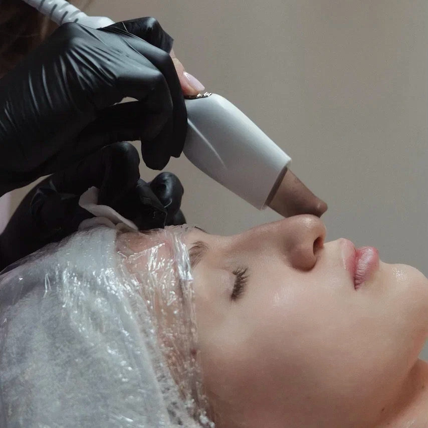 Ультразвуковая чистка лица