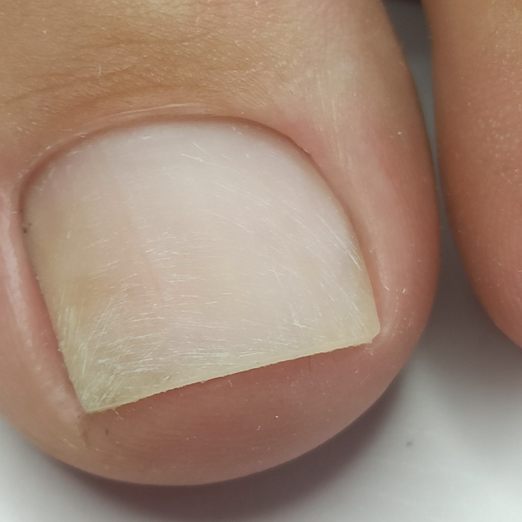 КОМБИНИРОВАННЫЙ ПЕДИКЮР ПАЛЬЧИКИ БЕЗ ПОКРЫТИЯ