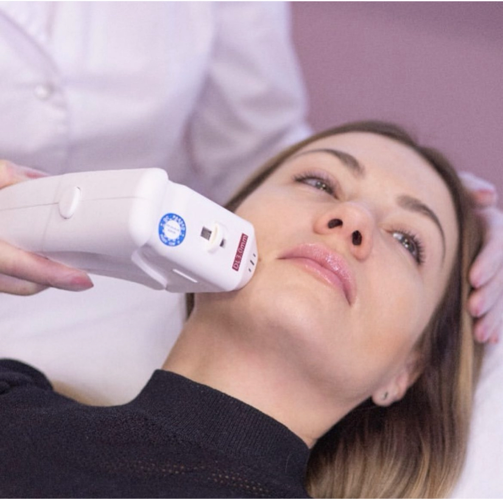 Smas-лифтинг лица