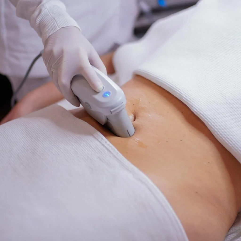 SMAS-лифтинг живота