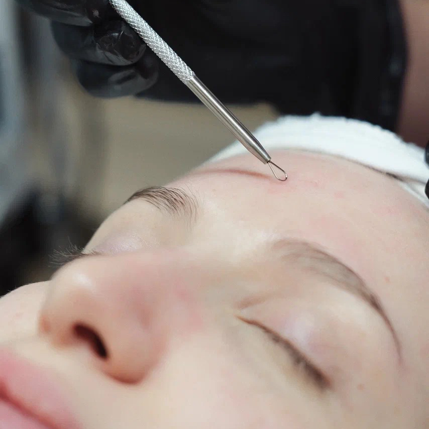 Механическая чистка лица