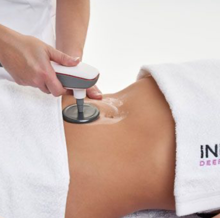 Подтяжка живота (Жиротоп INDIBA)