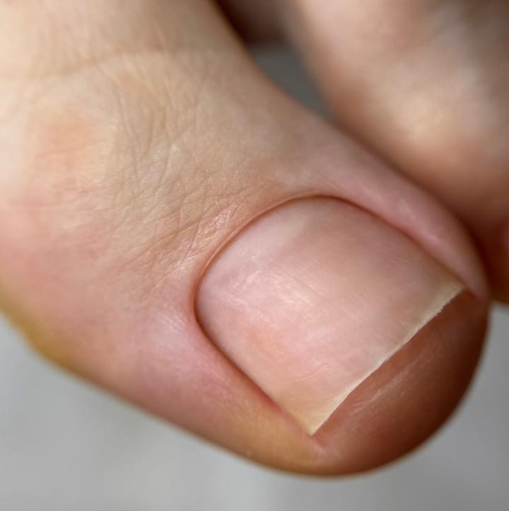 Педикюр гигиенический