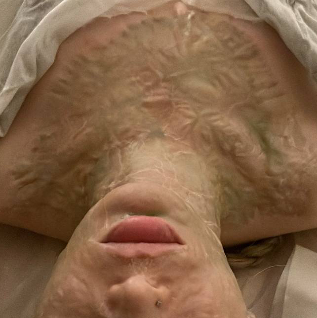 Ферментотерапия DMK