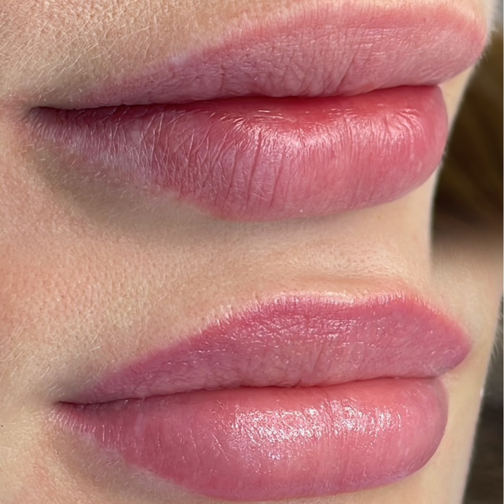 Пм (губы) (1 этап)