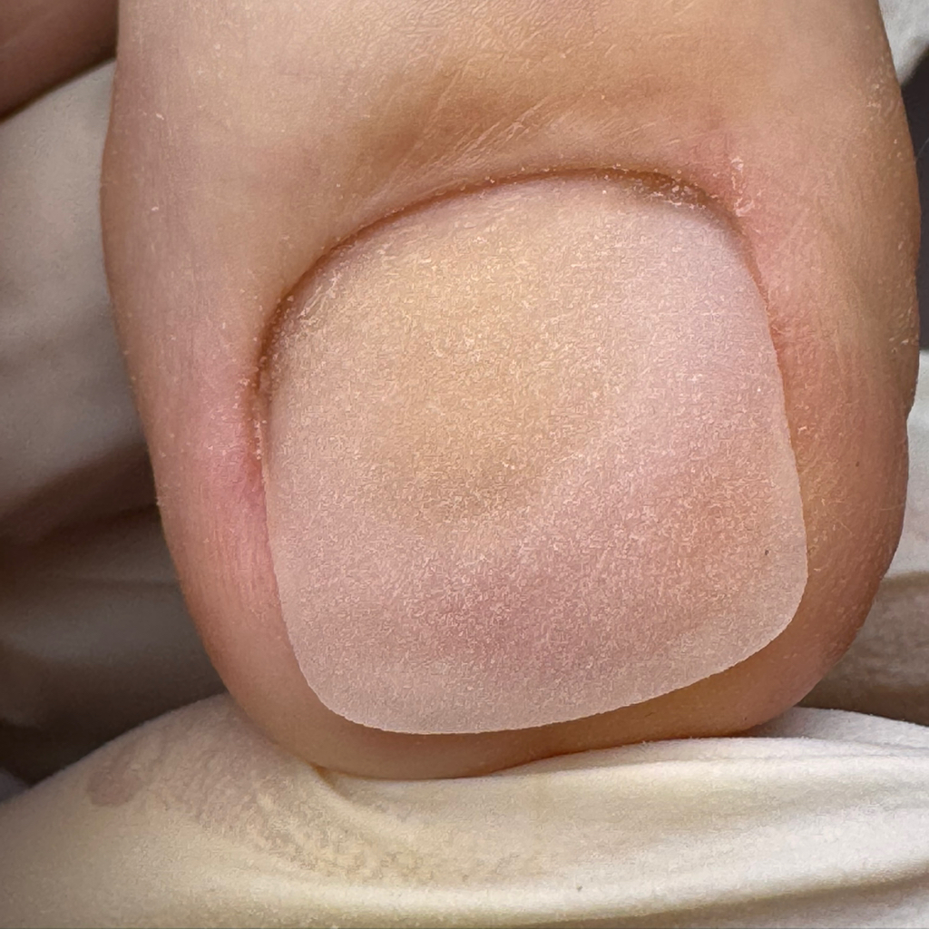 Протезирование ногтей 1 ед.(ноги)