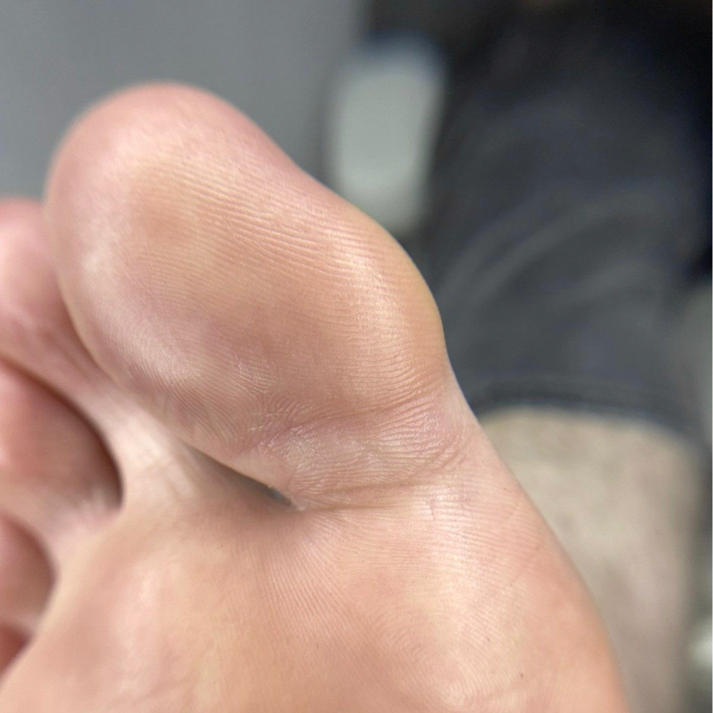 Мужской аппаратный гигиенический педикюр