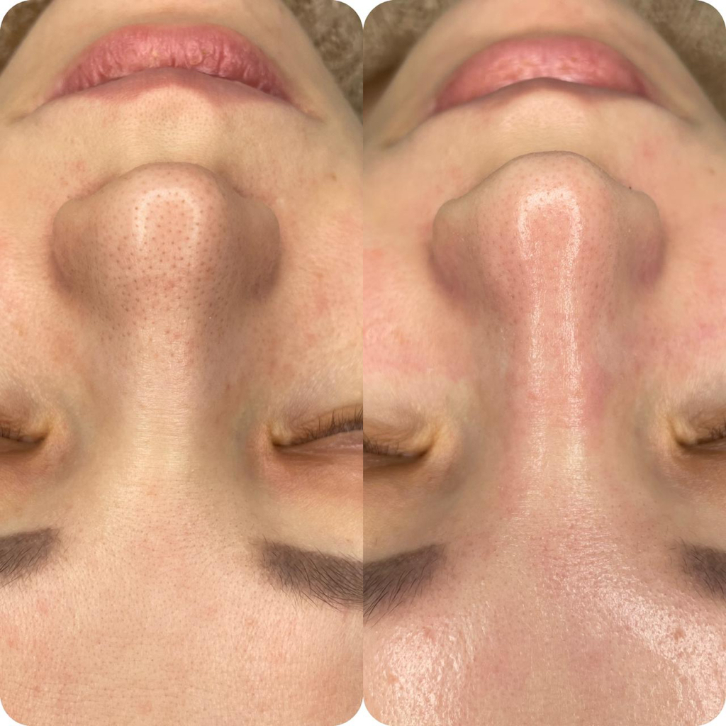 Расслабляющий уход