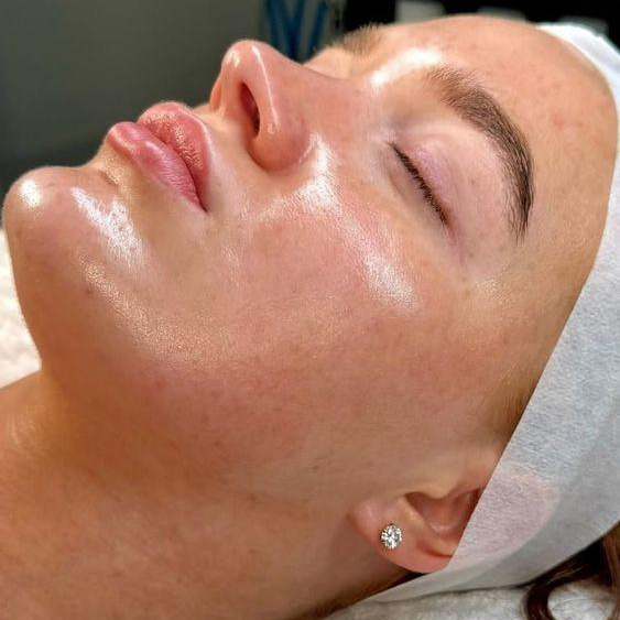 ПИЛИНГ PEACH PEEL СУПЕРФУД ДЛЯ КОЖИ С ЭФФЕКТОМ БИОРЕВИТАЛИЗАЦИИ