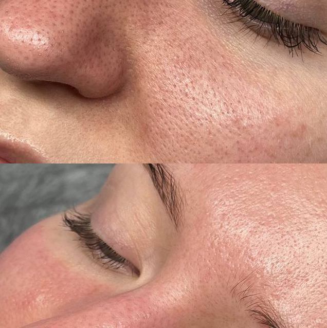 Консультация