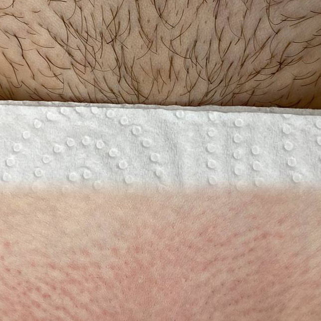 Шугаринг/депиляция глубокое бикини