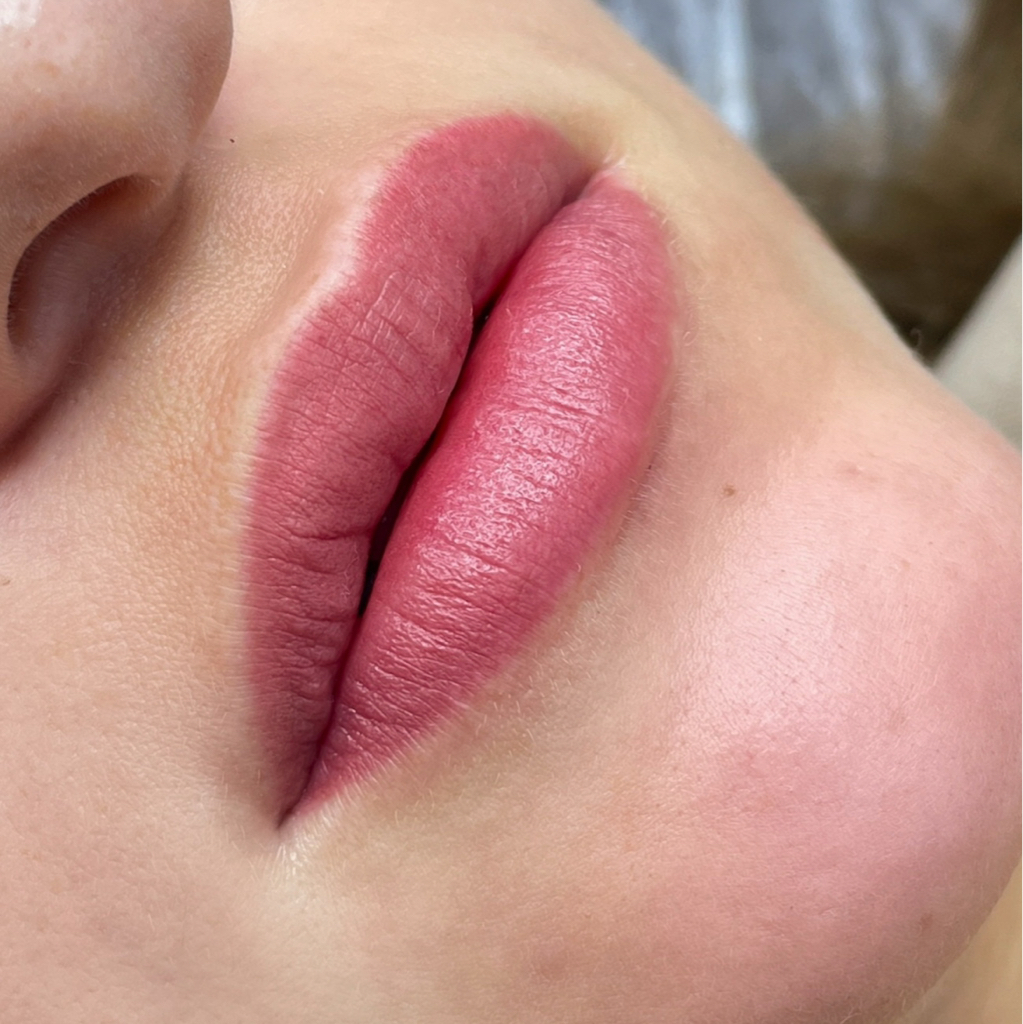 Обновление (губы) (спустя 6 мес и более)