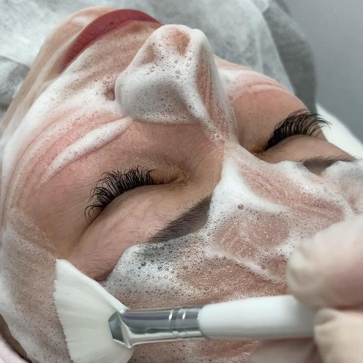 Карбокситерапия неинвазивная