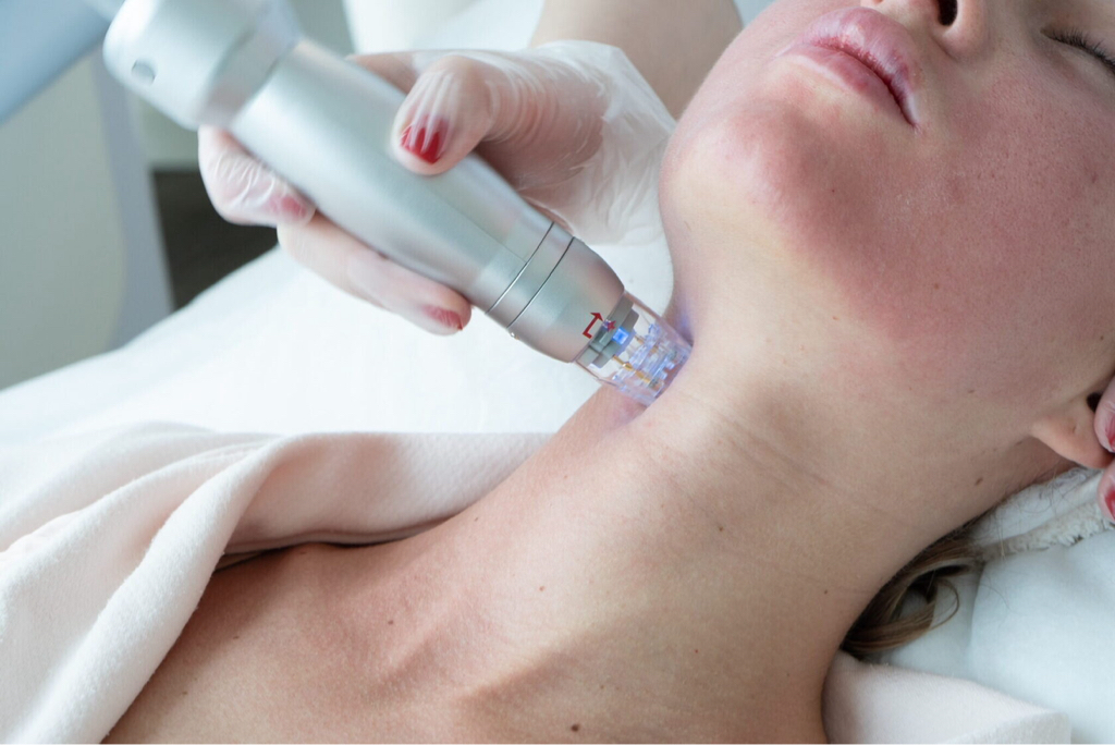 Игольчатый РФ