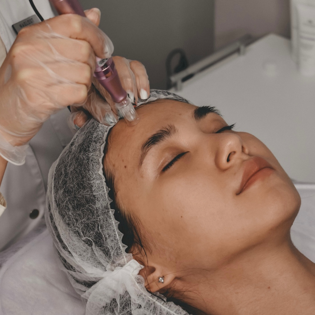 Фракционная мезотерапия лица и шеи