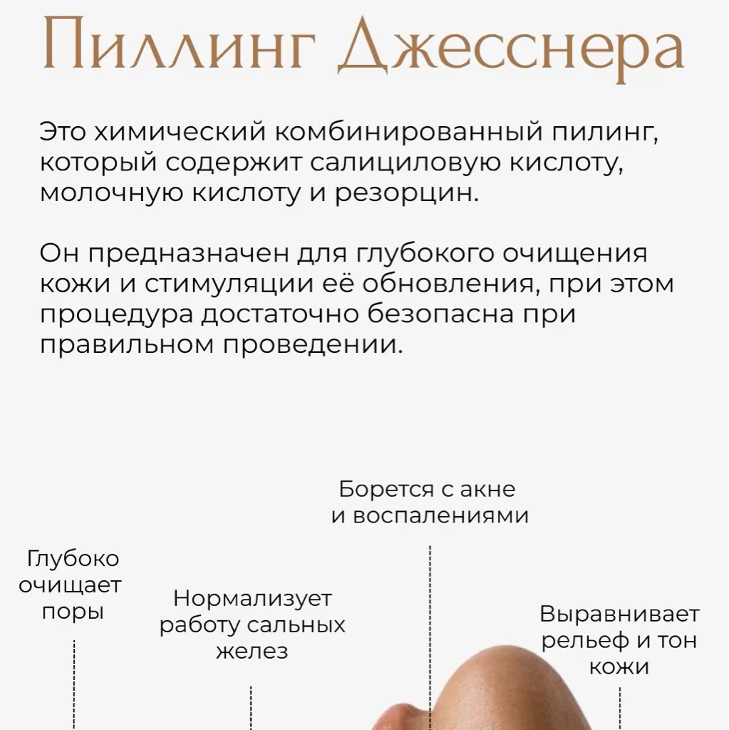 Пилинг Джеснера