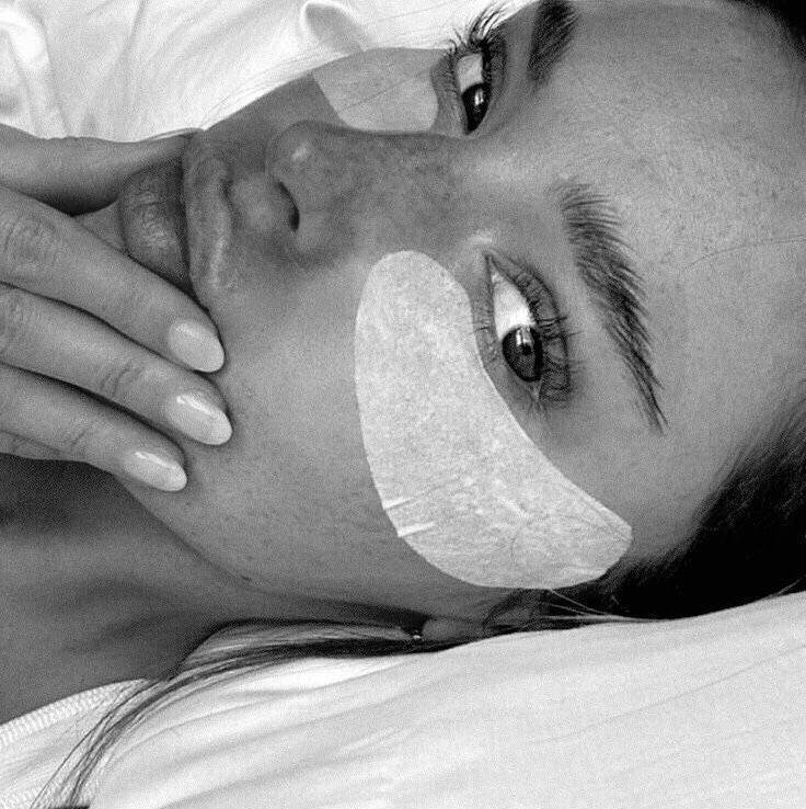 Щеки бакенбарды / лазерная эпиляция /