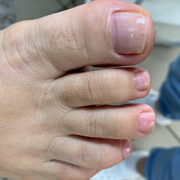 ПОДОЛОГИЧЕСКИЙ ПЕДИКЮР