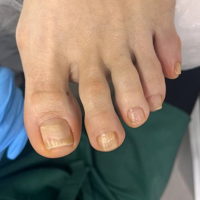 Гигиенический педикюр с массажем стопы  (без покрытия)