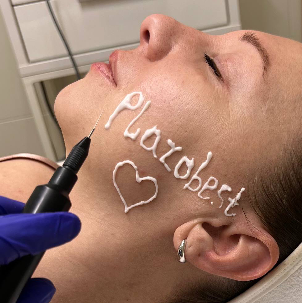 Холодная плазма (АКЦИЯ) Лицо +шея